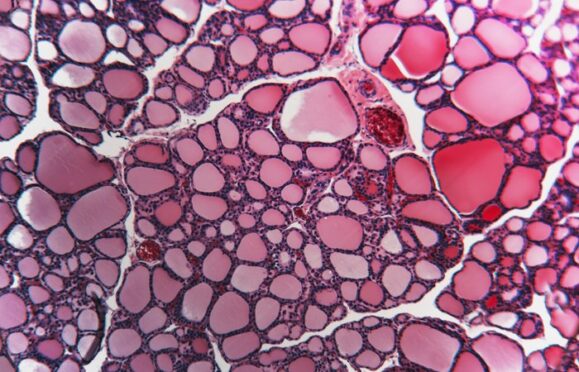 Microscopic view of liquid particles. 